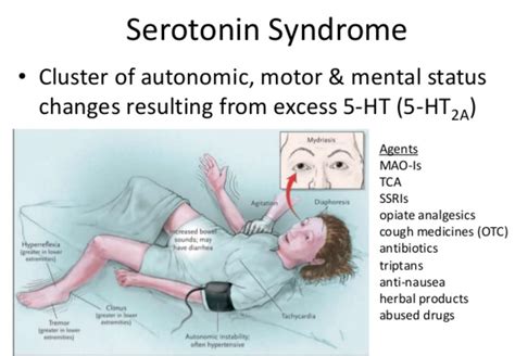 Drug-Induced Serotonin Syndrome. . How long to recover from serotonin syndrome reddit